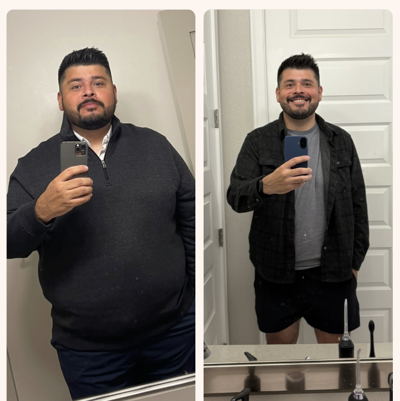 Carlos before and after