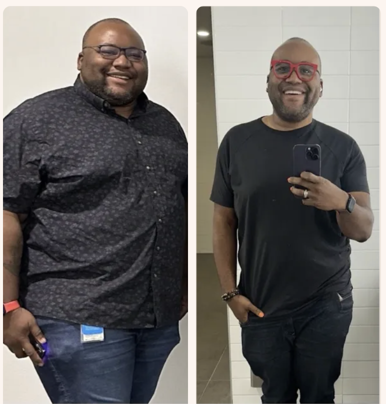 Marcus before and after