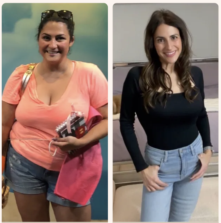 Nicole before and after